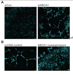 Cholesterol Role in Cancer